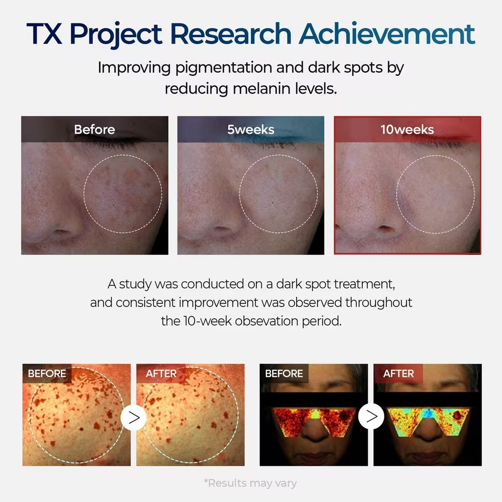 Dark Spot Corrector - TX -Cream
