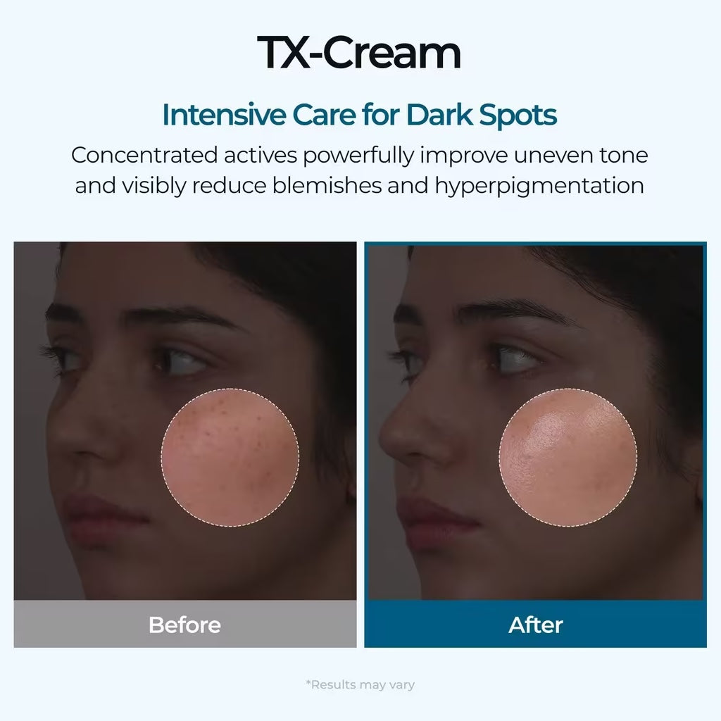 Dark Spot Corrector - TX -Cream