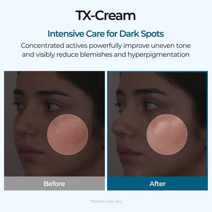 Dark Spot Corrector - TX -Cream