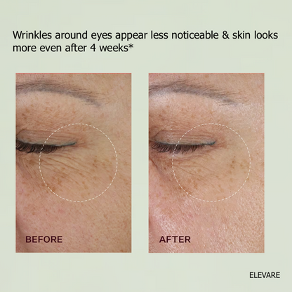 ELEVARE – Retinal Shot Tightening Booster