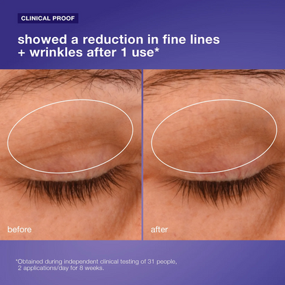 PDRN Lifting Eye Cream - PACK OF 3