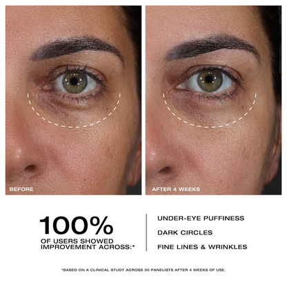 Calcium Dark Spot Cover Eye Cream